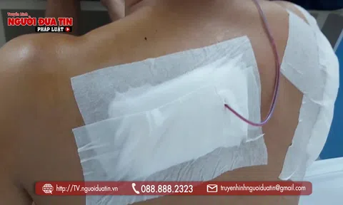 Hậu quả đáng tiếc từ mâu thuẫn cá nhân