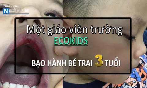 Trường mầm non Ecokids: "Mẹ hiền" đánh con chảy máu miệng