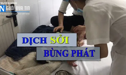 Hà Nội: Dịch sởi bùng phát trở lại