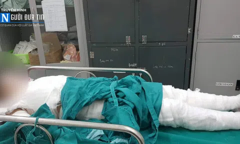 Lào Cai: Nghịch bình xịt chống thấm giày, bé trai bị bỏng toàn thân