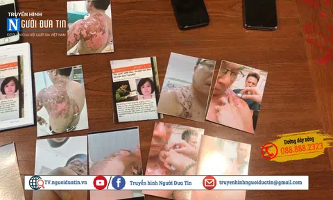 Vụ hắt nước sôi gây bỏng ở Nam Từ Liêm, Hà Nội: Bao giờ khởi tố?